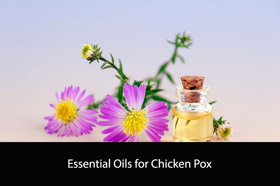 Essential Oils for Chicken Pox