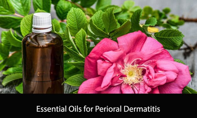 Essential Oils for Perioral Dermatitis