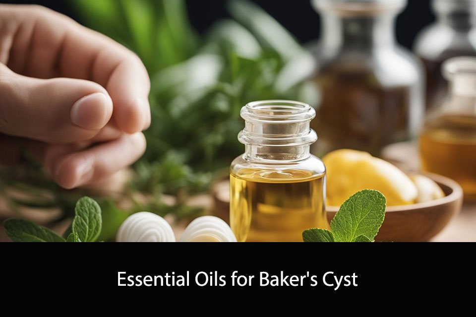 Essential Oils for Baker’s Cyst