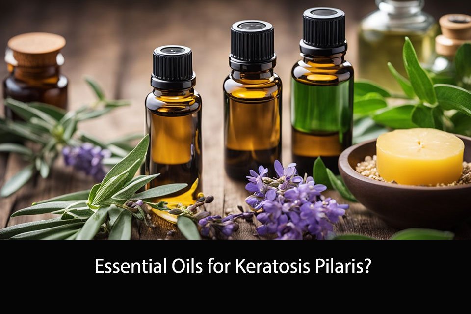 Essential Oils for Keratosis Pilaris
